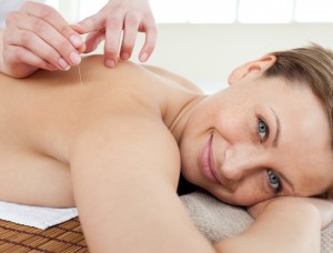 Kvinde ligger på briks og bliver behandlet med akupunktur